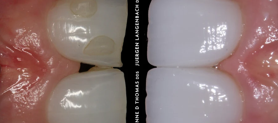 Pearls of Dentistry