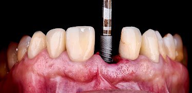 Perfect Smile Dental Centers - Dadeland