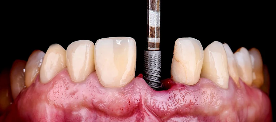 Perfect Smile Dental Centers - Dadeland