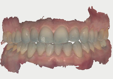 Pomona Dental Group