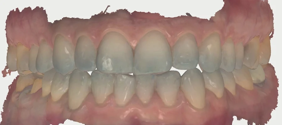 Pomona Dental Group