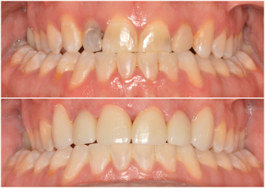 Ponderosa Dental Group