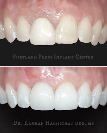 Portland Perio Implant Center