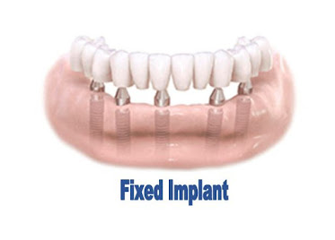 Premier Dental Center Boerne