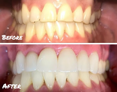 Premier Dental Health at Eagle Bend
