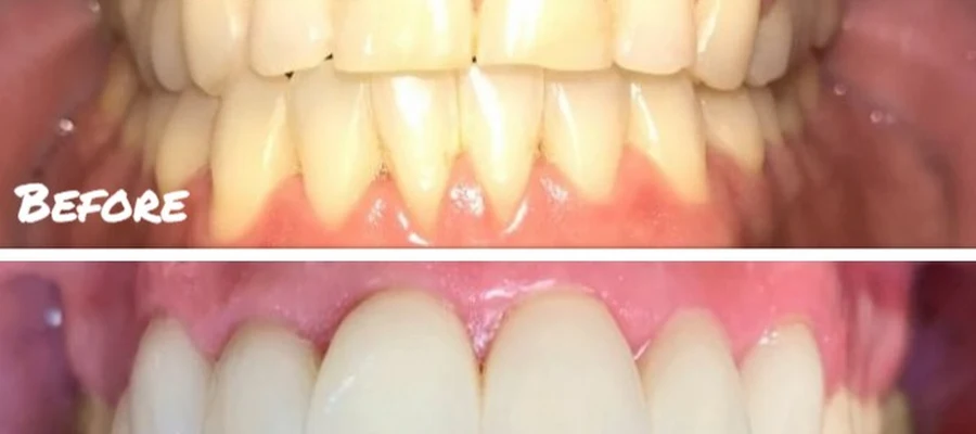 Premier Dental Health at Eagle Bend