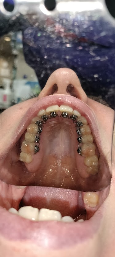 Premier Orthodontics