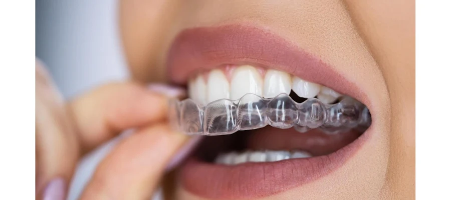 Prime Dentistry
