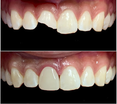 Professional Family Dental