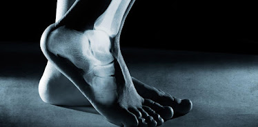 Rhode Island Foot Care