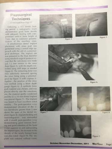 Richard E. Schell, DDS,MS. Oral and Maxillofacial Surgery and Dental Implants