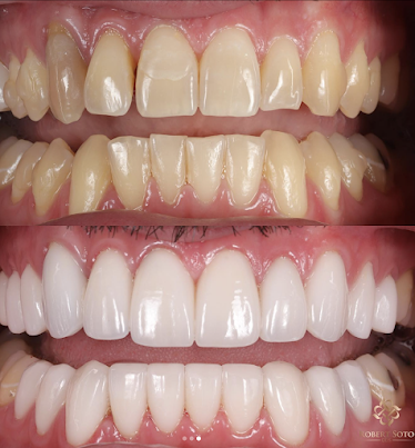 Robert Soto, DDS | Premier Cosmetic Dentistry in San Francisco