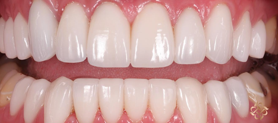Robert Soto, DDS | Premier Cosmetic Dentistry in San Francisco