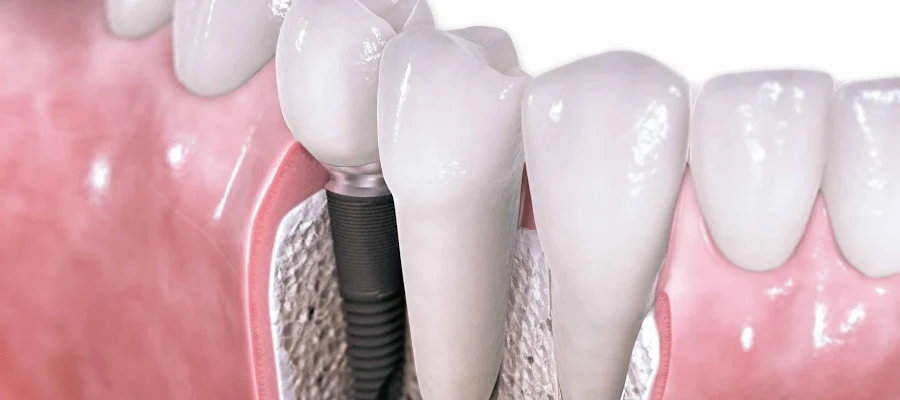 Sachs Family Dental