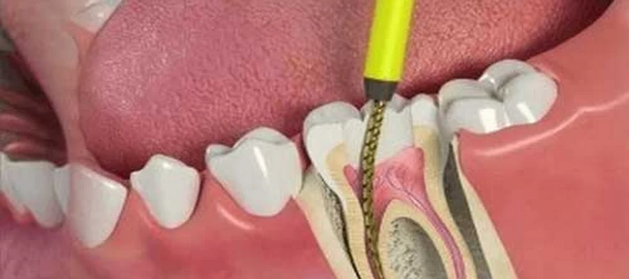 San Fernando & Pacoima Family Dental
