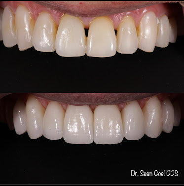 Schnierow Dental Care