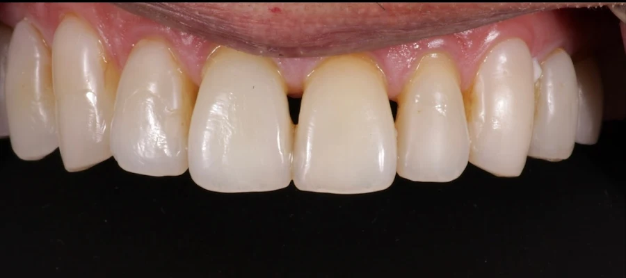 Schnierow Dental Care