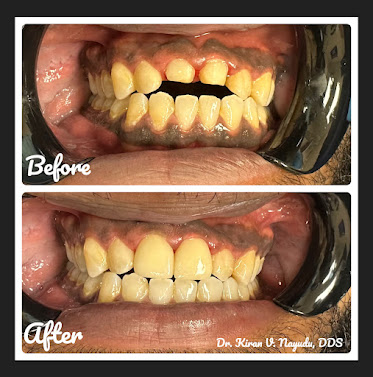 Signature Dental Center | Cosmetic Dentist in Frederick, Maryland