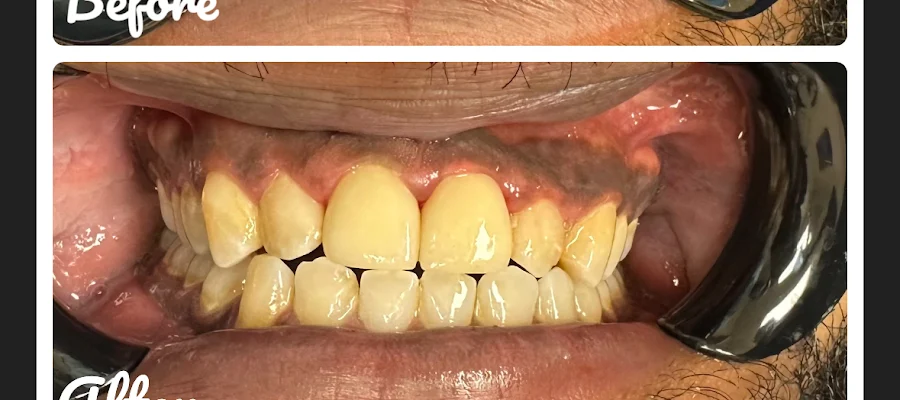Signature Dental Center | Cosmetic Dentist in Frederick, Maryland