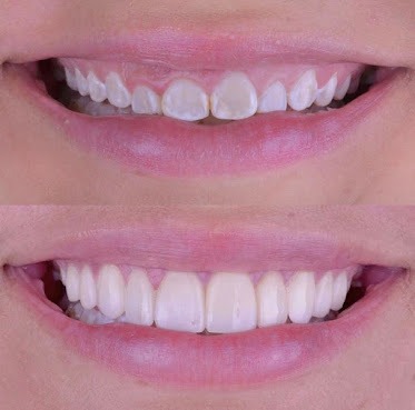 Simple Dental South Gate