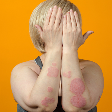 Skin Cancer Specialists