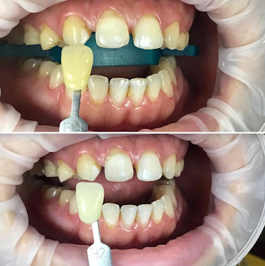 Smile Aurora Dental