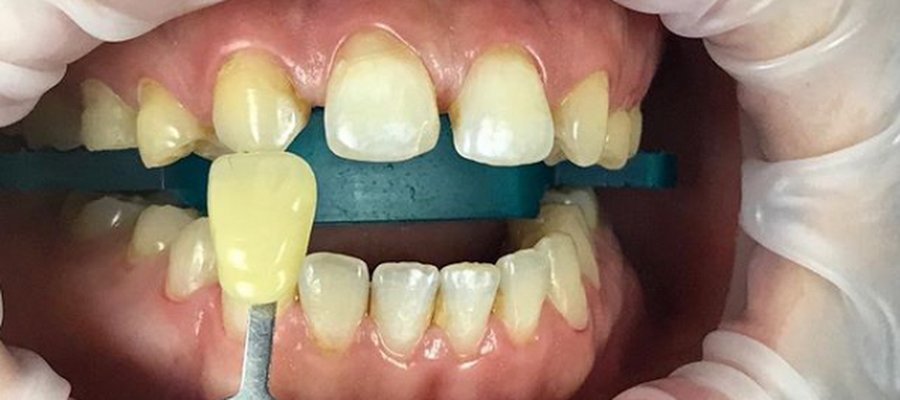 Smile Aurora Dental