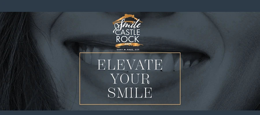 Smile Castle Rock