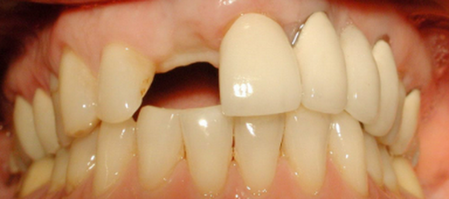 Smile Dental Implant Center - White Rock Dentists & South Surrey Dentists