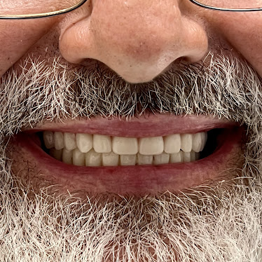 Smile Designers Dental Implant Center