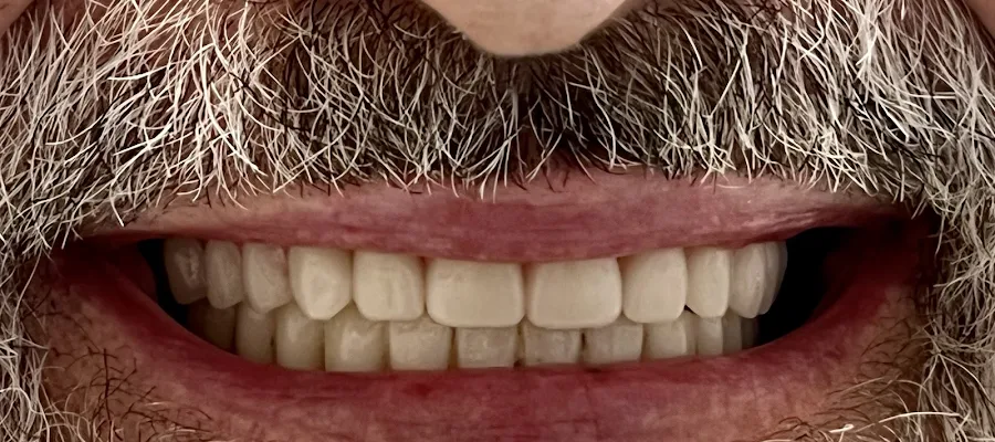 Smile Designers Dental Implant Center