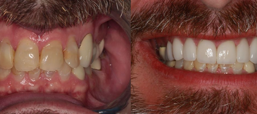 Southern Dental Implant Center