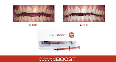 SPG Dental - Spencer