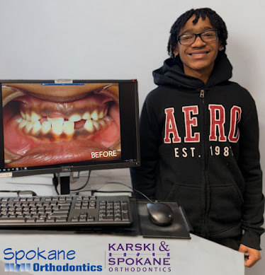 Spokane Orthodontics