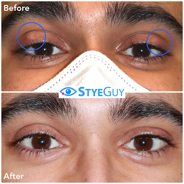 StyeGuy