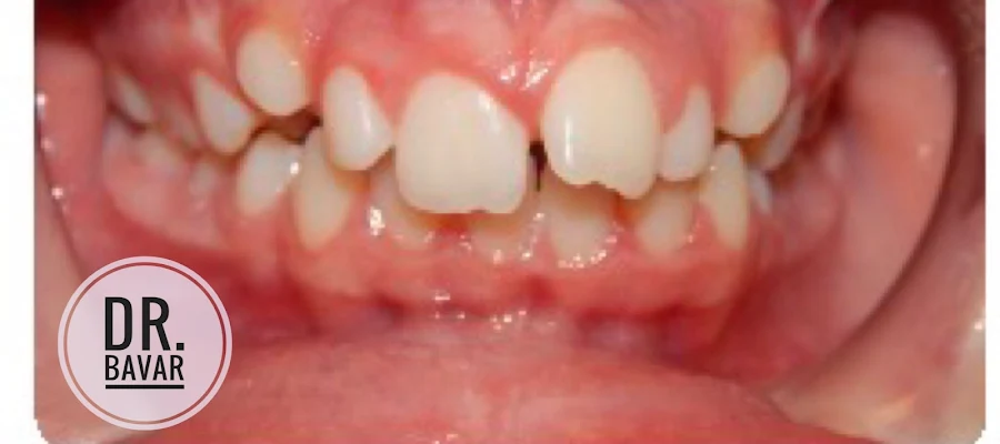 Toothworks of Bakersfield, Dentist and Orthodontist