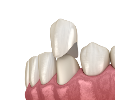 Trecartin Family Dentistry