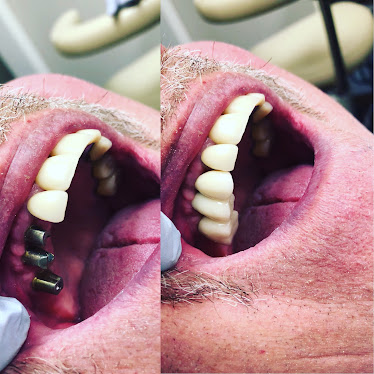 Troy smiles: Cosmetic and Implant Dentistry