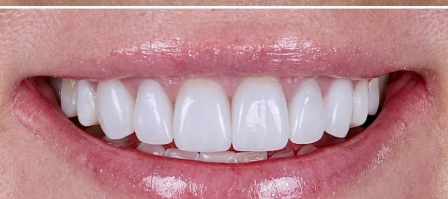 Van Nuys Panorama Dental Center