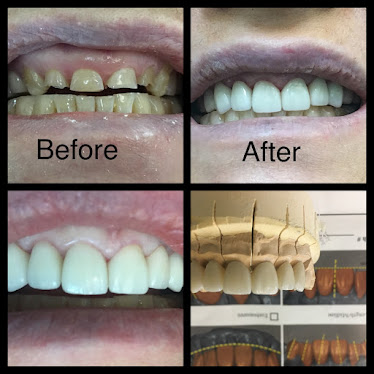 Vicken Marganian, DDS