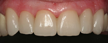 William J. Kinzler, DDS, MAGD, FICOI