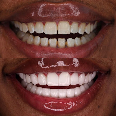Wonder Smile By Novva Smile